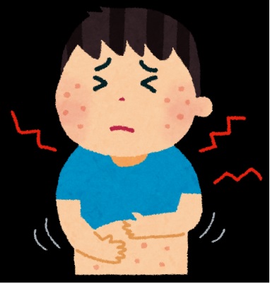 ジアノッティ-クロスティ症候群はアレルギー素因と関連するかもしれない