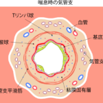 喘息予防ワクチンは可能か?:　レビュー