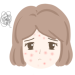 慢性じんましんは適切に治療されているか？