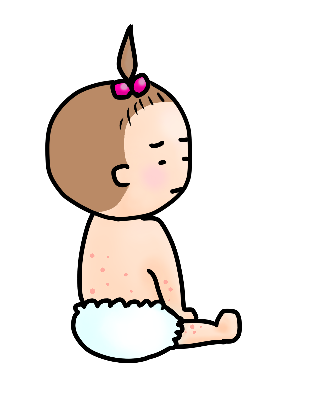乳児期早期に発症したアトピー性皮膚炎は、季節性アレルギーのリスクになる