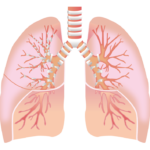 気管支サーモプラスティの組織学的変化は、臨床症状と相関するか？