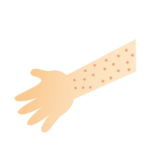 慢性蕁麻疹に対するザイザルとデザレックス、どちらがより有効か？