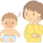 アトピー性皮膚炎があると、とびひになる可能性が1.8倍になる