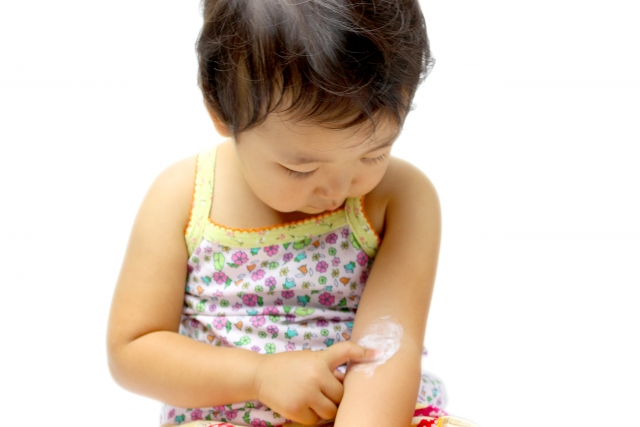 小児アトピー性皮膚炎にプロトピックとV群ステロイドはどちらが有効？