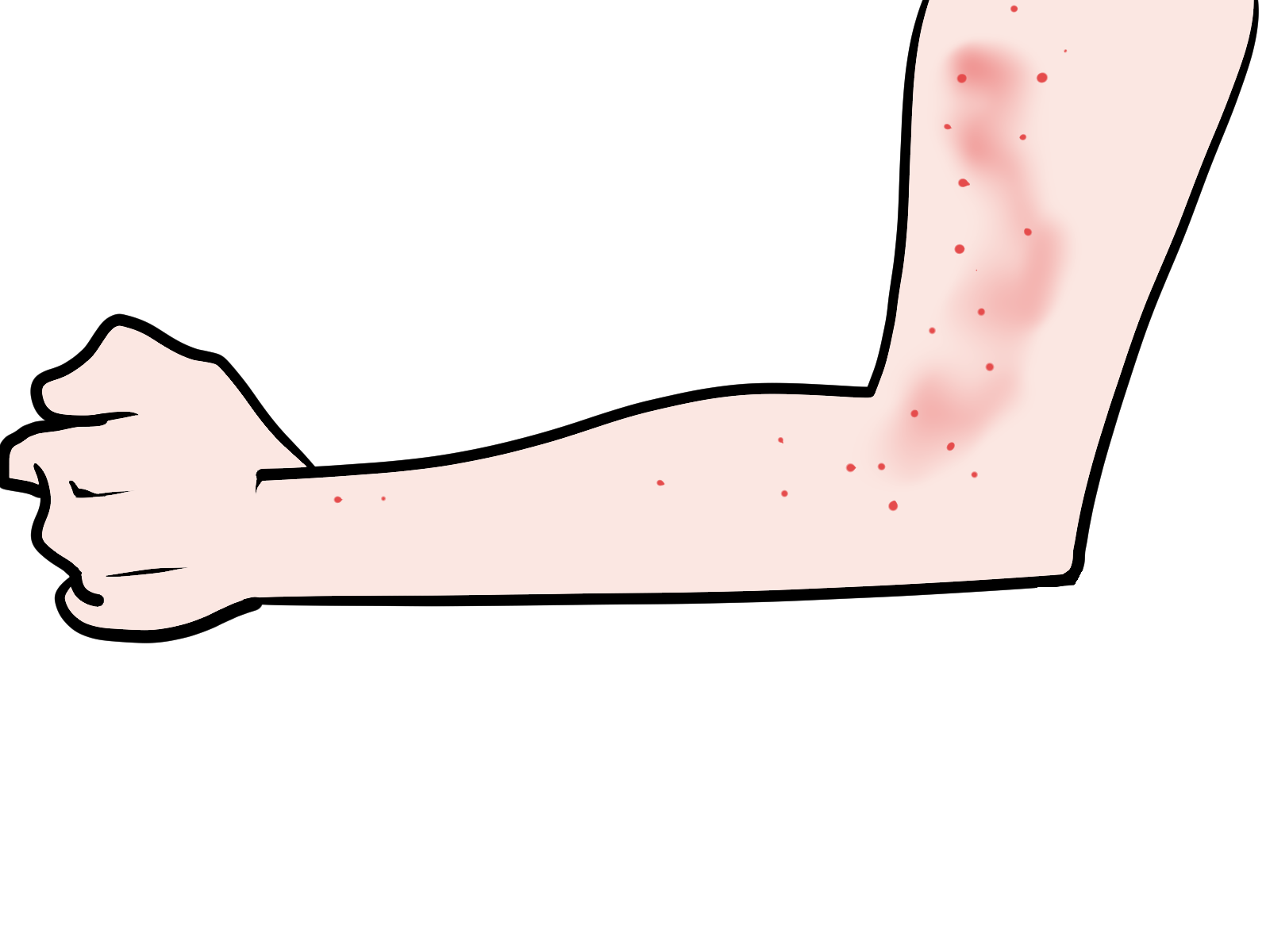 アトピー性皮膚炎の痒みを抑えるのに、どのような方法があるか？