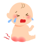 おむつかぶれ予防は、ベビーパウダーか？亜鉛華軟膏か？