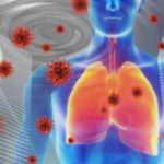 気管支喘息は、新型コロナ(SARS-Cov2)で悪化する原因になるか？（第1回/全2回）