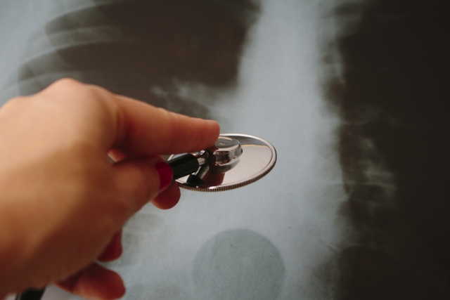 小児の発熱を伴う呼吸器症状に対し、肺炎を予測するツールはあるか？