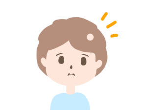 デュピルマブは、円形脱毛症に有効かもしれない：ランダム化比較試験